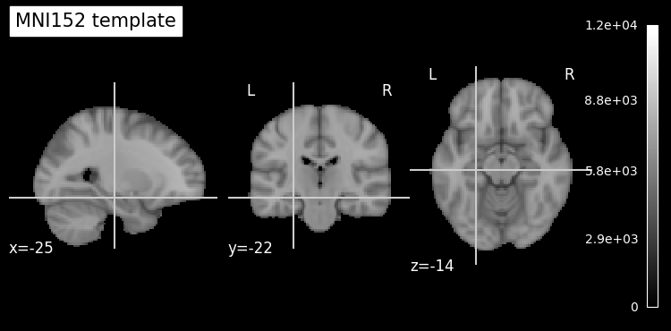 ../../_images/b43106613843ab6acae8ee9506f92ce0c136dbbed606bf9eee6624389e7685b8.png