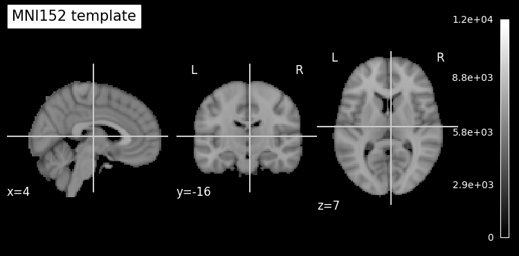 ../../_images/dc29f20be8a00e80a8c1648665712cf22bdb75fa84838efc7e096c6f2fdf7e2a.png
